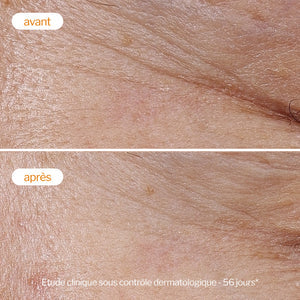 كريم نوفإكسبيرت "لايت كريم" بفيتامين C للإشراقة والنضارة - طبيعي 100%Novexpert The Vitamin C Light Cream - Radiance & Anti-Aging Care)