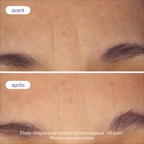 سيروم نوفإكسبيرت برو-ريتينول الثنائي المعزز لمحاربة التجاعيد وتجديد البشرة
